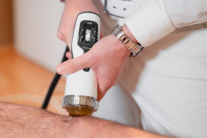 Vorschaubild für Stoßwellentherapie
